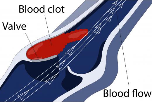 An elevated MPV means that the blood has a greater tendency to clot, which can increase the risk of cardiovascular disease.