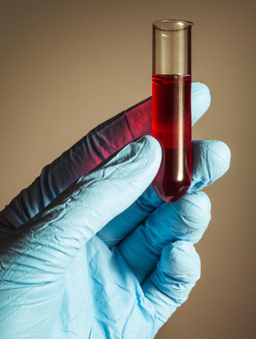 Receiving a blood transfusion will not alter your DNA profile.