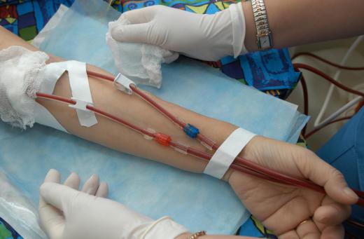 A blood test taken shortly after a whole blood transfusion may possibly show a mix of DNA coding.