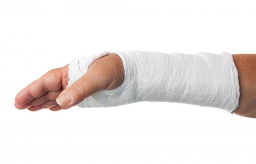 Plaster of Paris is used to make plaster casts for broken limbs.