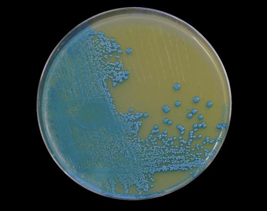Agar and bacteria in a petri dish.