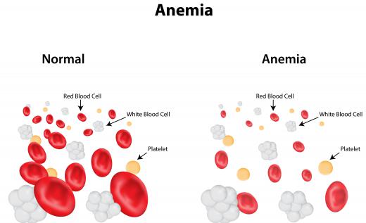 A transferrin saturation test may be performed if anemia is suspected.