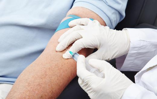 A blood test can be administered to test a person's transferrin saturation.
