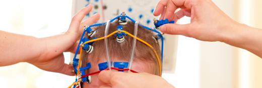 EEG electrodes are placed around the head in order to gather electrical impulses from the brain and direct these to a type of machine that is used as a diagnostic tool for analyzing brain activity.