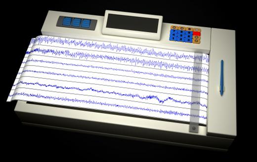 An electroencephalogram -- or EEG -- machine measures electrical impulse activity in the brain and can help give a diagnosis for conditions such as epilepsy.