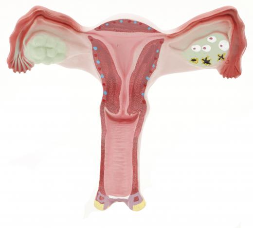 Fertilization occurs when a male sperm penetrates a female egg in the uterus.