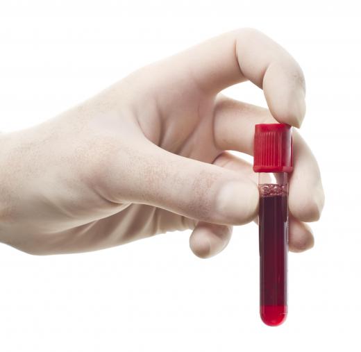 A blood sample is required to perform a glucose assay.