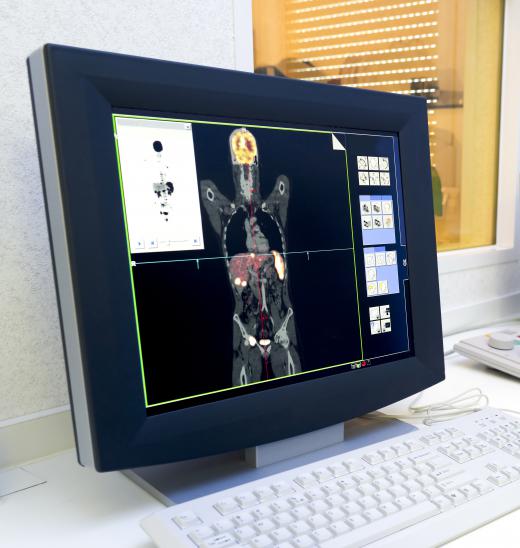 PET scans use positron-emitting tracers to produce a three-dimensional image of the body.