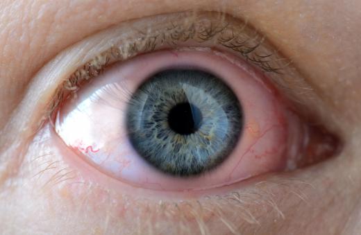 Contact with zirconium may cause eye irritation.