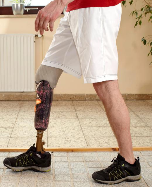 The technology used in prosthetic limbs as advanced greatly in the last few decades.