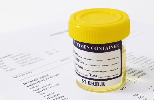 A urine sample.