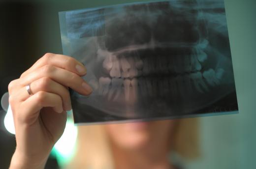 Digital radiography technology allows dentists to take several X-rays of patients' teeth without exposing them to dangerous levels of radiation.
